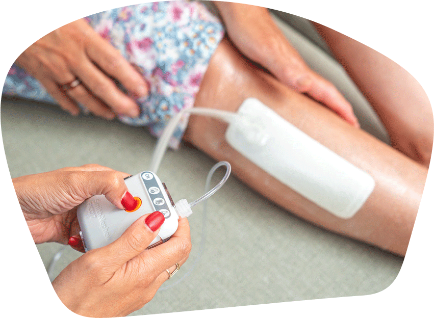 Hands holding PICO device with dressing on leg