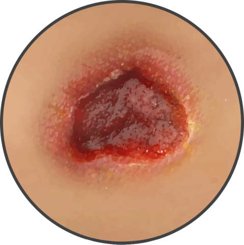 Micro and macro deformation icon